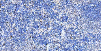 Musashi 1/Msi1 Rabbit Polyclonal Antibody