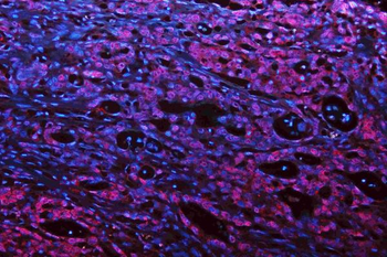 Musashi 1/Msi1 Rabbit Polyclonal Antibody