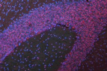 Musashi 1/Msi1 Rabbit Polyclonal Antibody