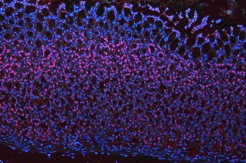 Musashi 1/Msi1 Rabbit Polyclonal Antibody