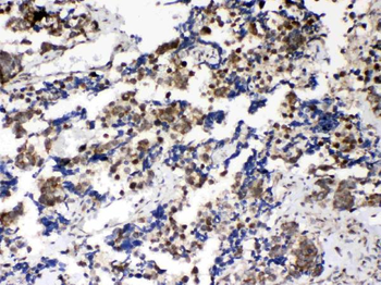 Musashi 1/Msi1 Rabbit Polyclonal Antibody