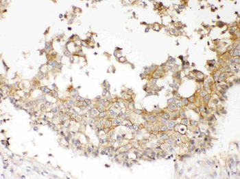 NDRG3 Rabbit Polyclonal Antibody
