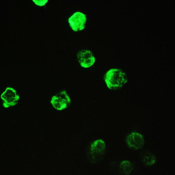 Cyclophilin A/PPIA Rabbit Polyclonal Antibody