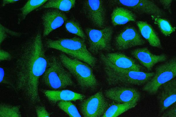 Cyclophilin A/PPIA Rabbit Polyclonal Antibody