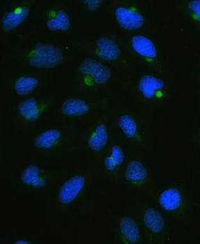 CPI17 alpha/PPP1R14A Rabbit Polyclonal Antibody