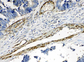 CPI17 alpha/PPP1R14A Rabbit Polyclonal Antibody