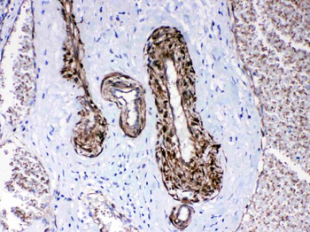 CPI17 alpha/PPP1R14A Rabbit Polyclonal Antibody