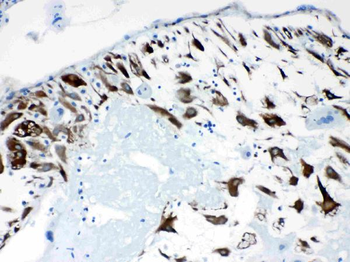 CPI17 alpha/PPP1R14A Rabbit Polyclonal Antibody