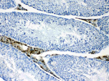 CPI17 alpha/PPP1R14A Rabbit Polyclonal Antibody