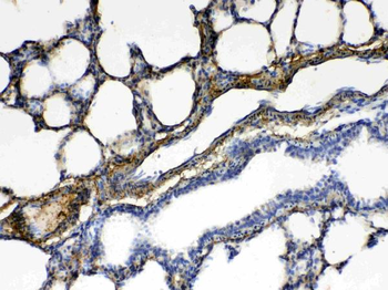 CPI17 alpha/PPP1R14A Rabbit Polyclonal Antibody