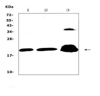 CPI17 alpha/PPP1R14A Rabbit Polyclonal Antibody