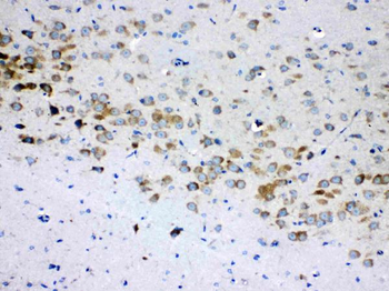 RPS6 Rabbit Polyclonal Antibody