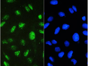 STAT1 Rabbit Polyclonal Antibody