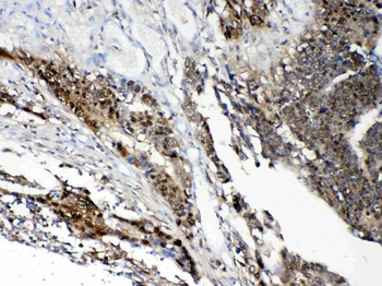 STAT1 Rabbit Polyclonal Antibody