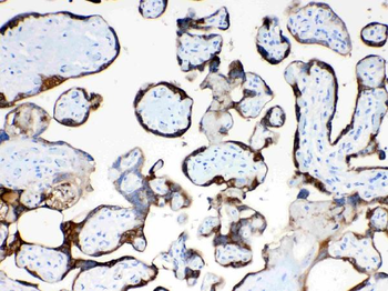 TFPI2 Rabbit Polyclonal Antibody