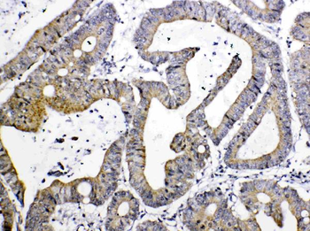 TIMP4 Rabbit Polyclonal Antibody