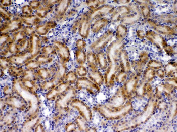 TIMP4 Rabbit Polyclonal Antibody