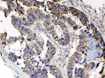 RANK/TNFRSF11A Rabbit Polyclonal Antibody