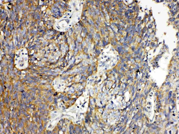RANK/TNFRSF11A Rabbit Polyclonal Antibody