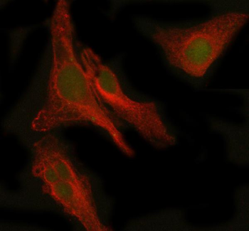 PEPD Rabbit Polyclonal Antibody