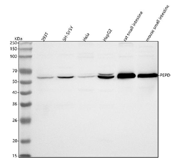 PEPD Rabbit Polyclonal Antibody