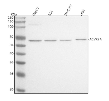 ACVR2A Rabbit Polyclonal Antibody