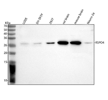 RSPO4 Rabbit Polyclonal Antibody