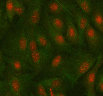 MAZ Rabbit Polyclonal Antibody