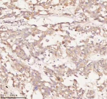 NUP43 Rabbit Polyclonal Antibody