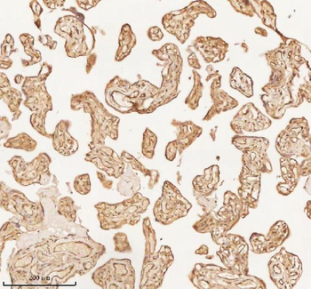 NUP43 Rabbit Polyclonal Antibody