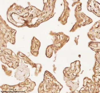 NUP43 Rabbit Polyclonal Antibody