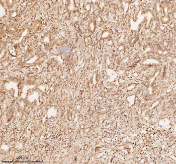 NUP43 Rabbit Polyclonal Antibody