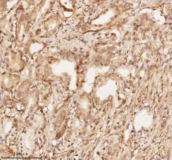 NUP43 Rabbit Polyclonal Antibody