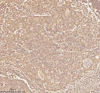 NUP43 Rabbit Polyclonal Antibody