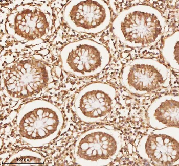 NUP43 Rabbit Polyclonal Antibody