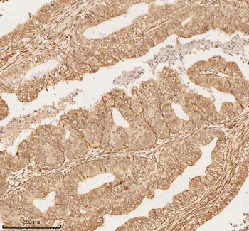 NUP43 Rabbit Polyclonal Antibody