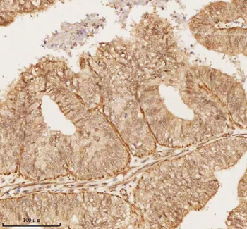 NUP43 Rabbit Polyclonal Antibody