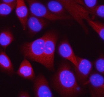 RPL14 Rabbit Polyclonal Antibody