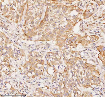 RNF25 Rabbit Polyclonal Antibody