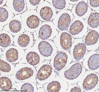RNF25 Rabbit Polyclonal Antibody