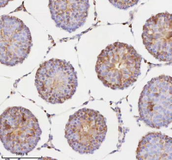 RNF25 Rabbit Polyclonal Antibody