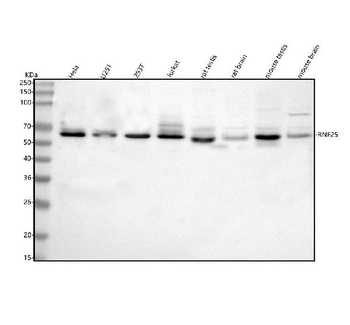 RNF25 Rabbit Polyclonal Antibody