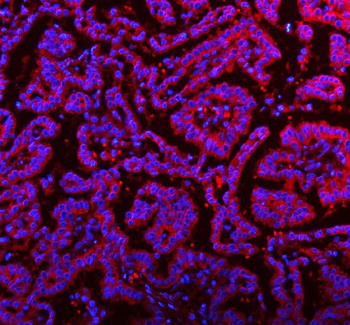RNF25 Rabbit Polyclonal Antibody