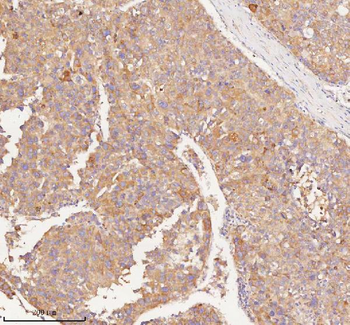 RNF25 Rabbit Polyclonal Antibody