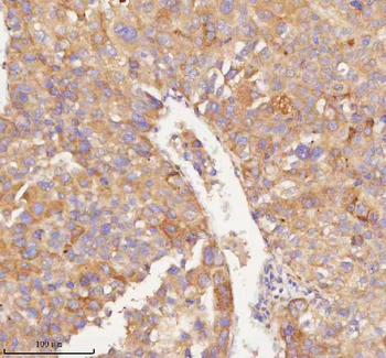 RNF25 Rabbit Polyclonal Antibody