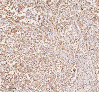 RNF25 Rabbit Polyclonal Antibody