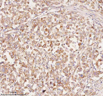 RNF25 Rabbit Polyclonal Antibody