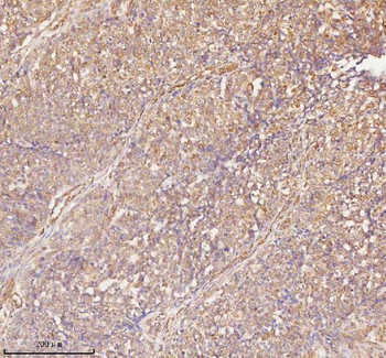 RNF25 Rabbit Polyclonal Antibody
