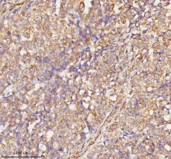 RNF25 Rabbit Polyclonal Antibody
