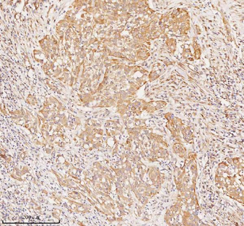 RNF25 Rabbit Polyclonal Antibody